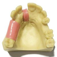 LXX Teeth Models Child Oral Teeth Teaching Model Adult Teeth Maxillary Missing Gums Standard Demonstration Tool for Study Teaching