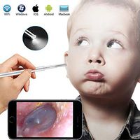 Otoscope iPhone - USB Otoscope Ear Speculum HD Camera, Ear Wax Remover with 14 Reuseable Ear Scope - 6 Adjustable Digital Flashlights Video Ear Cleaning Kit for Adult Children Pets