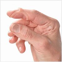 Oval-8 Finger Splint Refill, Size 11 (Pack of 5)