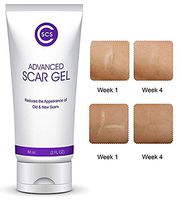 CSCS Most Effective Scar Remover Cream with Hydrolyzed Collagen & Vitamin E - Heals Old & New Scars from Cuts, Acne, Stretch Marks, Burns & Post Surgeries Scars - Fast Results, for All Skin Types 2 oz