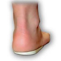 Heel Wedge Large (Pack of 2) Treat: Pronation, Flat Foot, Plantar Fascia