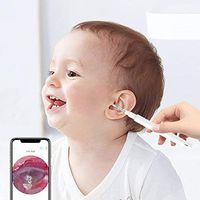 HD Visual Ear Spoon, Soft Silicone Earwax Removal Tool, USB Connected HD Endoscope for Ear, Oral Cavity, Nasal Cavity for Android Phone, Windows,Blue
