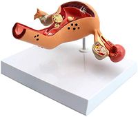 LXX Human Anatomical Model,Medical Anatomical Uterus Ovary Vagina Lesion Model 1:1 Life Size Reproductive Gynecological Medical Demonstration Model