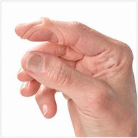 Oval-8 Finger Splint Refill, Size 5 (Pack of 5)