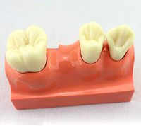 LXX Dental Teaching Anatomy Model, Removable Teeth Mode- PVC Material Detachable Stomatology Caries Decomposition Teeth Model for Dental Students Adult