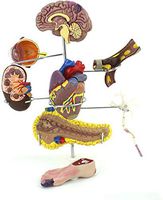 LXX Human Anatomy Science Models -Diabetes Organ Model,Complication Cerebral Heart Pancreatic Neuron Surgery - for Medical School Student Educational Training Aid
