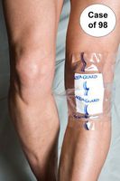 12" x 14" AquaGuard PICC Line Cover Moisture Barrier Case