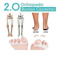 Dragon Honor Orthopedic Bunion Corrector 2.0 Toe Separators (1pair)