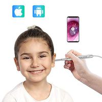Teslong Digital Otoscope for iPhone, 4.3mm Ultra-Slim Visual Ear Cleaner with Adapter, Earwax Removal Tool, Washable Speculum Tips and Carrying Bag