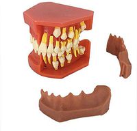 LXX Teeth Teaching Model,Anself Dental Deciduous Teeth Child Teeth Teeth Model Adult Teeth Gums Standard Demonstration Tool Doctor-Patient Communication Model