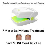 Highly Effective Rechargeable Nail Fungus Laser Treatment Device for Onychomycosis Cure. This Instrument is for Home use and Treats Nail Fungus and infections. Easy use and Fast Results.