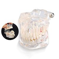 LXX Dental Demonstration Teeth Model Transparent Adult Pathologies Dental Dentist Oral Repair Pathological Active Tooth Model for Medical Science Teaching Research