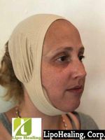 Facial Compression & Chin Support Continual Chin Support Light Compression ONE Size Beige Lipofoam Strips and Wipes Included by LipoHealing, Corp. Unisex