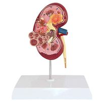 LXX Scientific Human Anatomy - Human Kidney Anatomical Model - Medical Educational Training Aid - Teaching Decoration Statue
