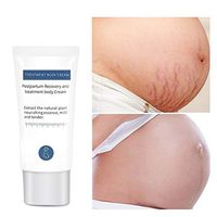 Stretch Mark Cream for Pregnancy, Stretch Mark Scar Cream, Pregnant Women Only Postpartum Repair Cream Repair Scar Slack Line Abdomen Stretch Marks Postpartum (30g)