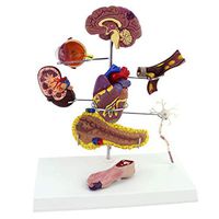 LXX Scientific Human Anatomy - Diabetes Organ Model - Complication Cerebral Heart Pancreatic Neuron Surgery - Medical Educational Training Aid