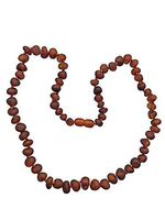 UMAI Baltic Amber Adult Necklace - Unpolished Cognac - 18 inches Long - Anti-inflammatory - Natural Relief for Pain, Inflammation, Headaches and Migraines