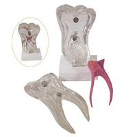 LXX Teeth Model Dental Removable Adult Teeth Model Dentist Standard Pathological Tooth Teaching Tools Six Times The Ratio