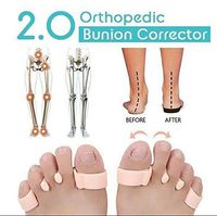 HappyFeet Orthopedic Bunion Corrector 2.0