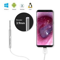 Teslong Ultra Thin Otoscope, 3.9mm HD Visual Ear Cleaner Ear Scope Camera with 6 LED Lights, Earwax Cleaning Tool and Washable Speculum Tips, Works with Android, Winows, Mac & Linux