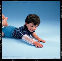 Urias Pressure Splints ADULT: Splints: Elbow, Approx. Max Circ.: 16 1/2" (42cm), Chambers: Single, L