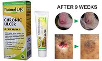 NaturalQR Chronic Ulcer Healing Cream | Developed by a Dermatologist | 100% Herbal and Ayurvedic Treatment for Chronic Ulcers, Pressure Sores, Bed Sores, and Rashes | 30 Gram Tube