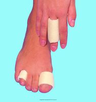 Softeze Finger and Toe Bandages - 5/8" inner diameter 36" roll
