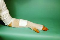 Mt Spandage Tubular Elastic Dressing Retainer 4/Large Hand/Arm/Leg/Foot