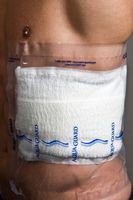 12" x 24" AquaGuard PICC Line Cover Moisture Barrier