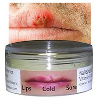 Cold Sore Treatment Silica Jelly Mouth Lips Herpes Blisters Cankers Fungus (10 ml) ALKAVITA