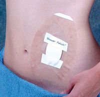 Brown Medical Seal-Tight - Shield Shower Patch (Pack of 5)