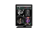 Barco Eonis MDRC-2221 2MP Color Medical Diagnostic Radiology Monitor (K9301880A) (Renewed)