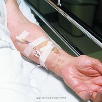 3M Durapore Surgical Tape, Durapore Tape Silk.5 in, (1 BOX, 24 EACH)