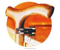 Mountain Properties Cane Accessories, Cane Holder, (1 EACH, 1 EACH)