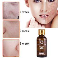 Freckle Lighten Essential Oil, Elevin(TM) Blemish Essential Oil Decomposition Pigment Whiten Moisturizing Anti Wrinkle (10ml)