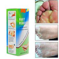 Wart Remover Foot Corn Removal Chicken Eye Liquid Wart Treatment Foot Corn Foot Callus Body Callus Calluses Foot Care Pads Wart Remover Corn Treatment Remover Plantar Wart Plantar for Women Man