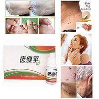 Skin Tag Remover 10mL, Mole & Genital Wart Remover