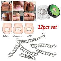 Ugthe 6/12Pcs Ingrown Toenail Correction Wire Fixer Foot Care Pedicure Recover Tool - 12pcs