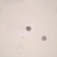 Entamoeba coli Cysts, Smear Microscope Slide