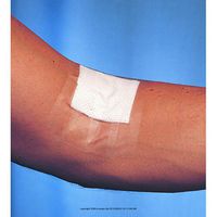 3M Blenderm Tape, Blenderm Plstc Tape 1 in X5, (1 BOX, 12 EACH)