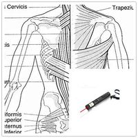 COZING Acupuncture Pen Meridian Energy Pen Electro Acupuncture Care Pen Massage Rechargeable Sports Injury Management