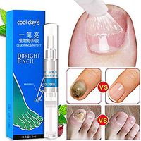 Fungal Nail Treatment Toe Fungus Removal Anti Infection Onychomycosis Liquid Pen