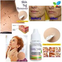 Wart Remover, STCORPS7 Body Warts Treatment Skin Tag Remover Foot Wart Remover Wart Liquid 2 in 1 Wart Removal ＆ Repair Set Painlessly Removes Common and Plantar Warts Remover