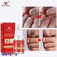 Lavender Fungal Nail Treatment Essential Oil Nail Art & Tools Promote Nails Grow Healthy Nail Treatment Onychomycosis Foot Care