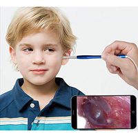 JJWBA Earscope Visual Ear Scoop Glowing Digging Ear Scoop/Ear-Picking Endoscope Pull-Out Hd Earglass Check Children's Ears Mouth Nasal Nose Endoscope