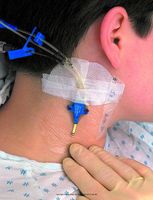 3M Tegaderm Transparent Film Dressing, Tegdrm Drs Trn 4X4.75 in, (1 BOX, 10 EACH)