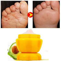 Chinese Medicinal Foot Cream Heel Scratched Repair Athlete's Foot Beriberi Removal Anti Dry Crack Foot Care