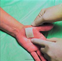 3M Tegaderm+Pad Film Dressing with Non-Adherent Pad, Tegdrm Drs Cmpsit 2X2.75 in, (1 EACH, 1 EACH)