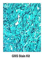 K1427-125 - Description : GMS Stain Kit - GMS Stain Kit, BioVision Inc. - Each (125ml)