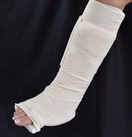 ReadySplints Custom Ankle Fiberglass Splint for Adults
